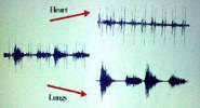 Three sound graphs